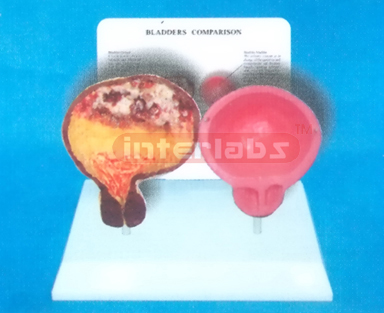 DESK-TYPE, GALL BLADDER MODEL FOR COMPARISION DEMONSTRATING HEALTHY MAN THAN SMOKING MAN WITH DESCRIPTION PLATE